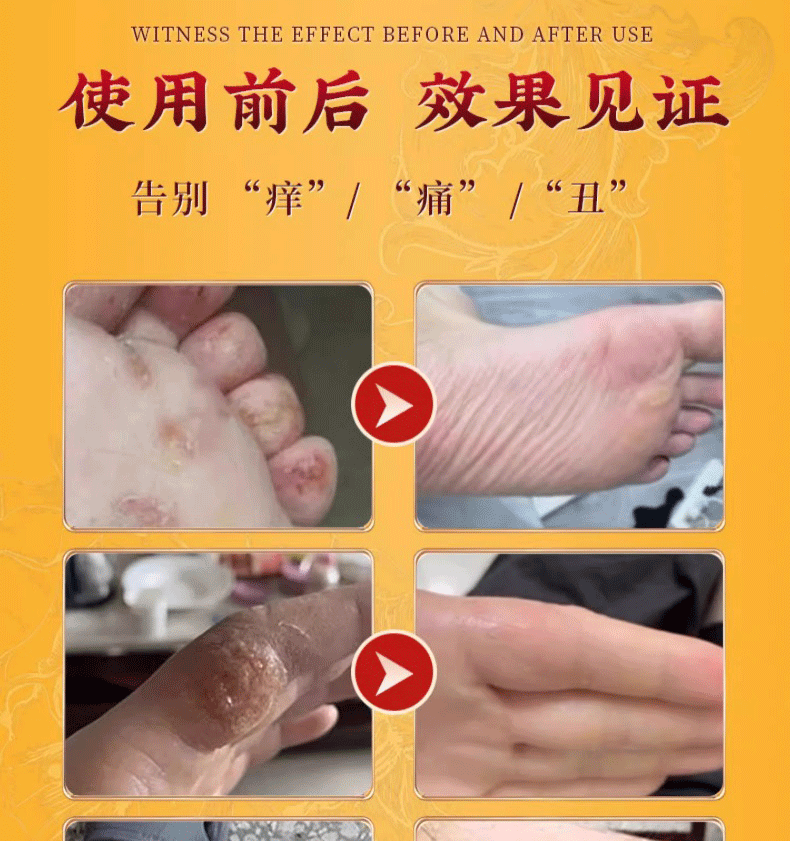 【中国直邮】 祥医堂 断痒王 止痒膏皮肤痒断痒膏 一抹止痒 草本秘制 安全健康 30g/盒