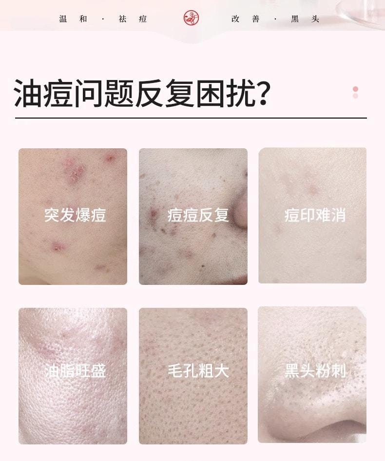 【中国直邮】 歌宝莲 15%壬二酸祛痘凝胶 去黑头痘印 收缩毛孔粉刺 30g/支