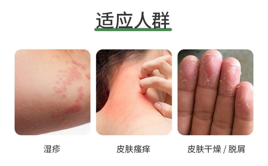 【中國直郵】 YULIN廣西玉林製藥 濕毒清片 用於治療德國麻疹皮膚乾燥慢性蕁麻疹帶狀皰疹感染 24片/盒