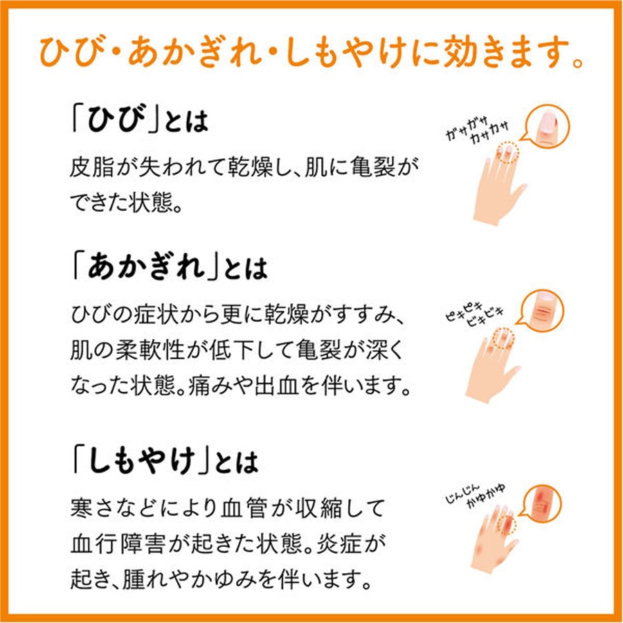 【日本直郵】 悠斯晶 YUSKIN 維生素乳霜 防乾裂 滋潤保濕 護手霜 圖案包裝隨機發 40g