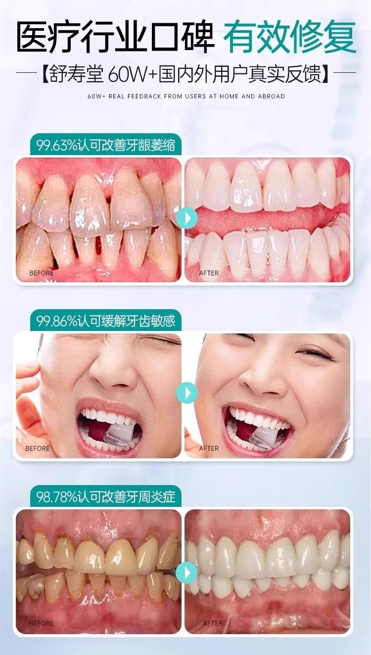 【中國直郵】 醫用口腔護理脫敏膏 120g/支 舒緩牙齦敏感 輔助維護牙周健康