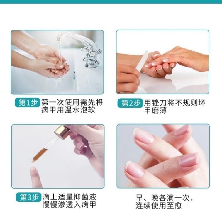 【中國直郵】 香港大藥房 鹽酸阿莫羅芬搽劑 灰指甲專用藥腳氣甲癬甲真菌病 30ml/盒(養成好甲)