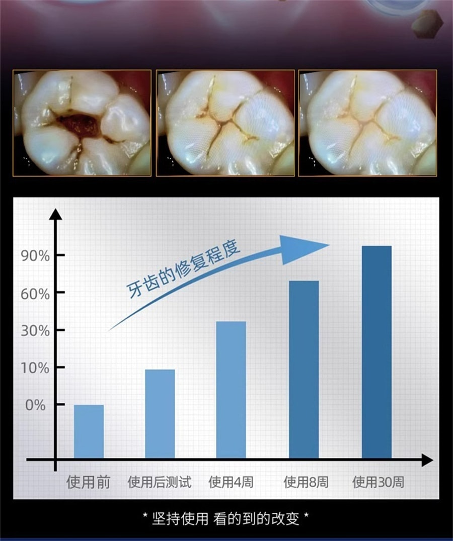 【中國直郵】正大 再生矽牙膏1支 牙周炎專用牙齦萎縮修補再生蛀牙牙洞清理齲齒非藥