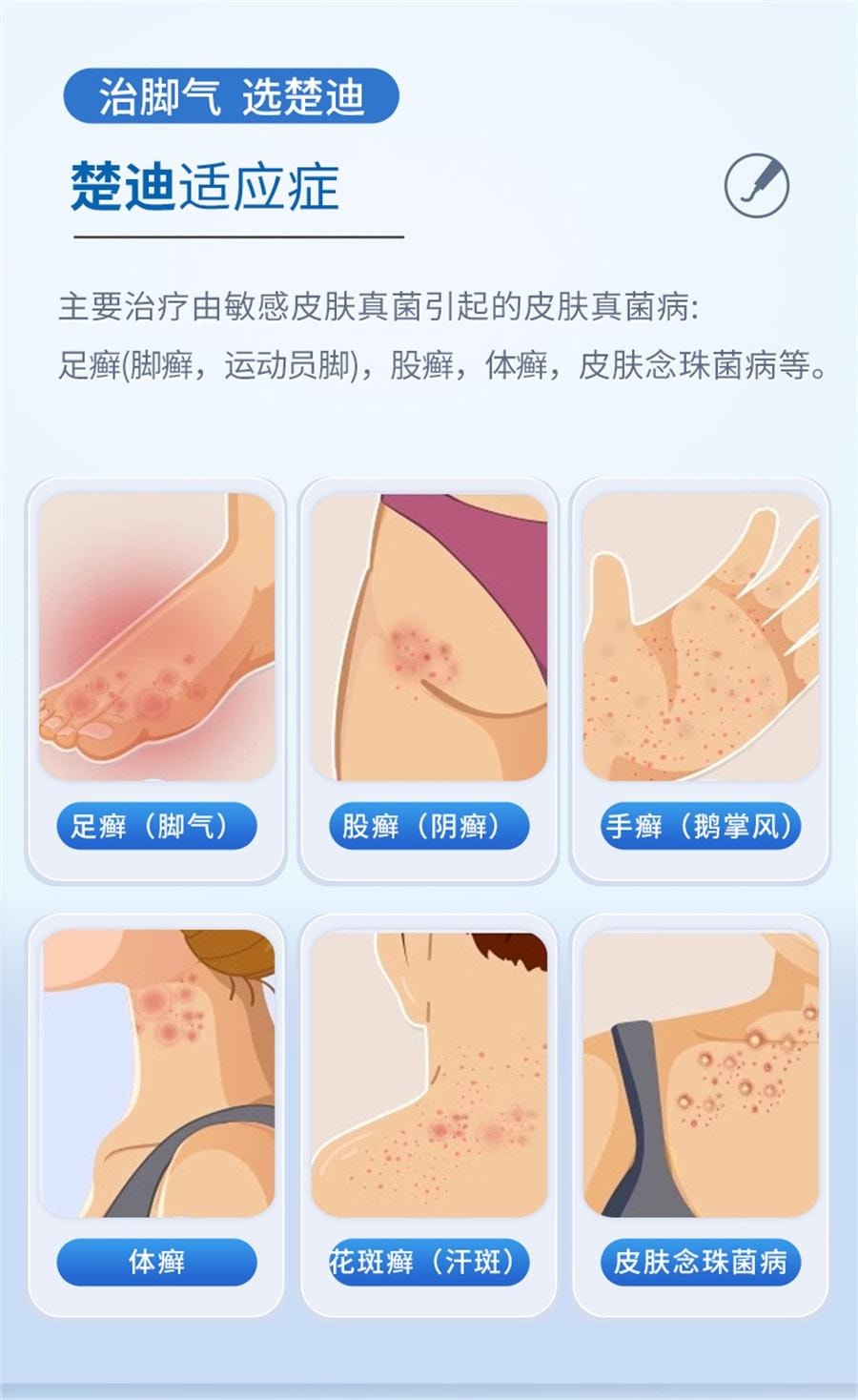 【中国直邮】 楚甲 盐酸阿莫罗芬乳膏 去脚气治脚气脱皮止痒杀菌 30g/支