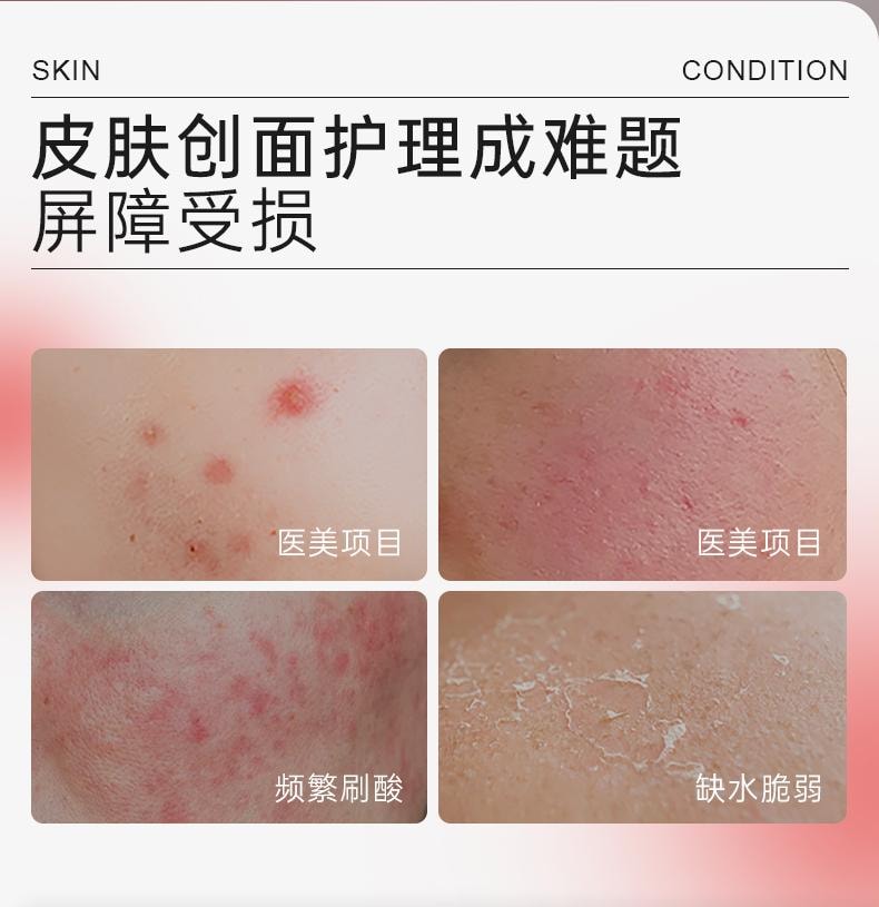 Medical Sodium Hyaluronate Dressing-Black 5 Sheets