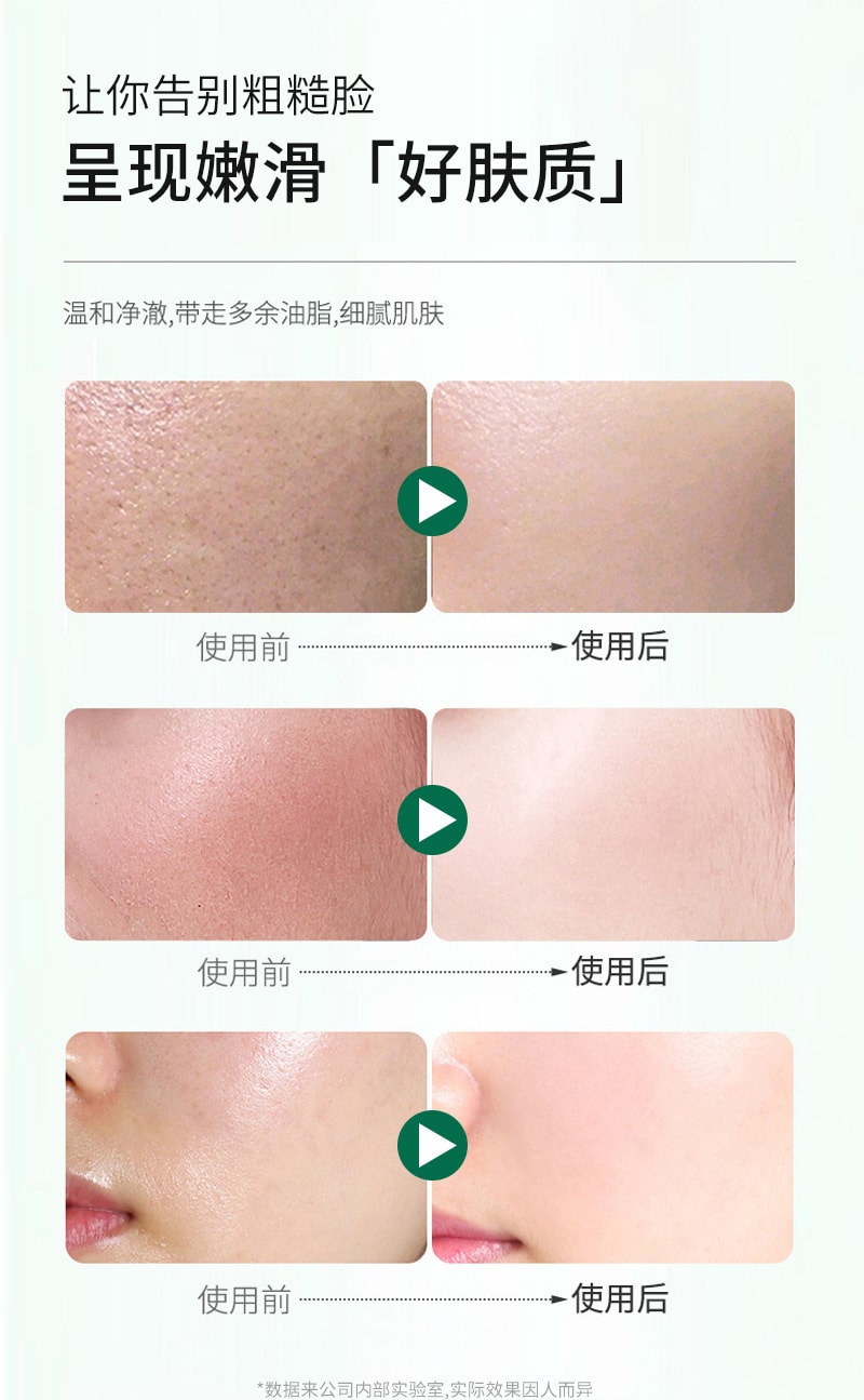 【中国直邮】稚漾 水杨酸焕肤绿泥膜黑泥膜清洁毛孔补水控油保湿高岭土涂抹面膜 5g/10粒