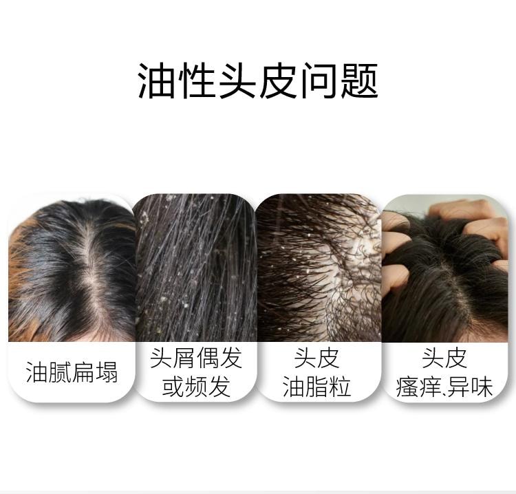 【中国直邮】 John Jeff 姜黄洗发水300g 蓬松头发 控油去屑 一次蓬松2~3天