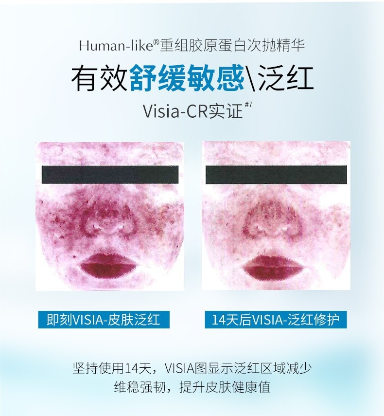 [中国直邮]可复美Comfy 胶原棒human-like重组胶原蛋白肌御修护次抛精 1.5ml 30支1盒
