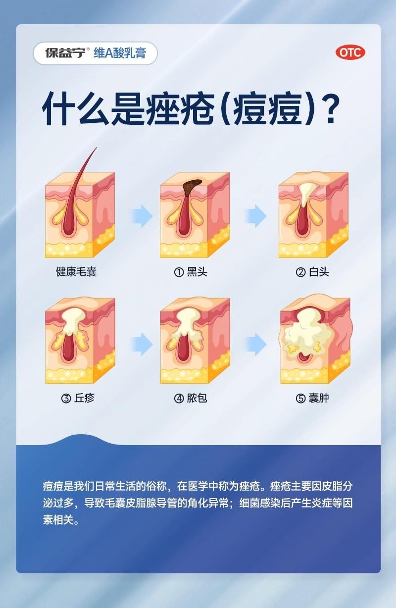 【中国直邮】 保益宁 维A酸乳膏 改善粉刺 淡化痘印 软化角质 科学祛痘 20g/盒
