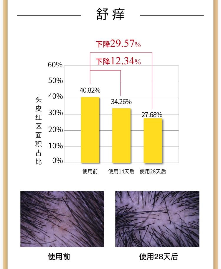 【中国直邮】 John Jeff 二硫化硒洗发水300g 去屑舒痒 告别油扁塌 三效合一