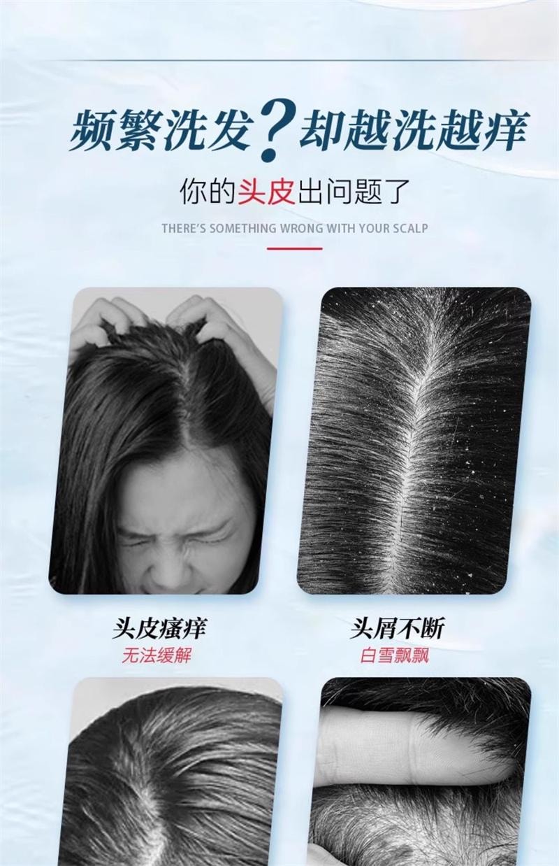 【中国直邮】 999 二硫化硒洗剂去屑洗头水控油洗发液止痒洗发水露 200ml
