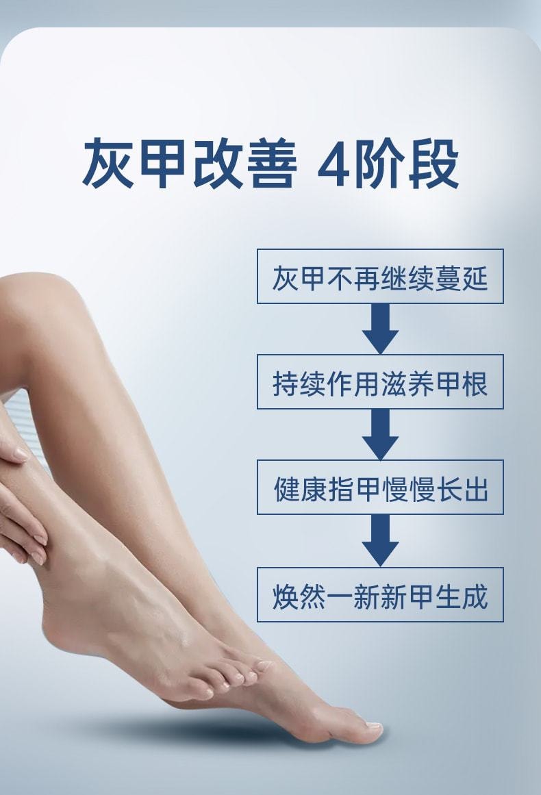 【中国直邮】 易复美 冰醋酸溶液涂剂 泡脚灰甲抗抑菌指甲专用冰乙酸稀释 100ml/瓶
