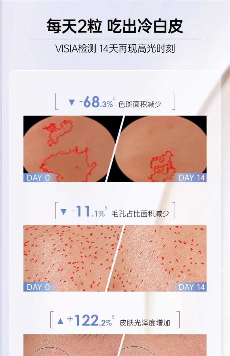 【中国直邮】 碧维斯 打斑美白丸全身美白淡纹祛斑谷胱甘肽葡萄籽褪黑丸40粒/盒