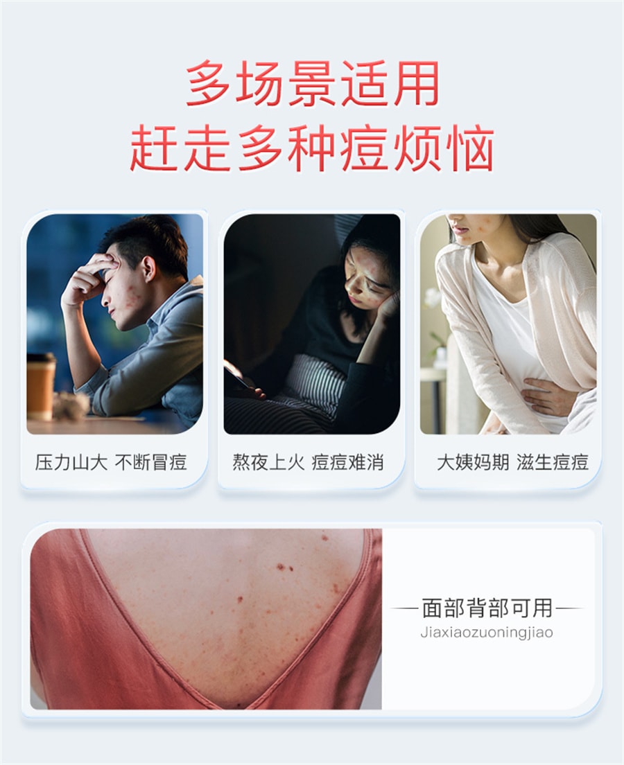 【中國直郵】 喜遼妥 甲硝唑凝膠消炎祛痘藥膏修復淡化痘印甲硝銼凝膠 20g/支