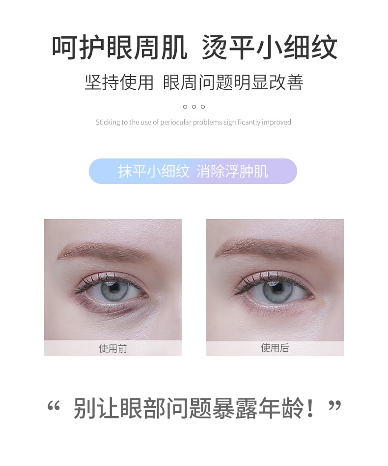 【中國直郵】卡蕾蘭眼部按摩儀器淡化眼袋神器美眼棒黑眼圈美容儀導入眼霜減緩皺紋 紫