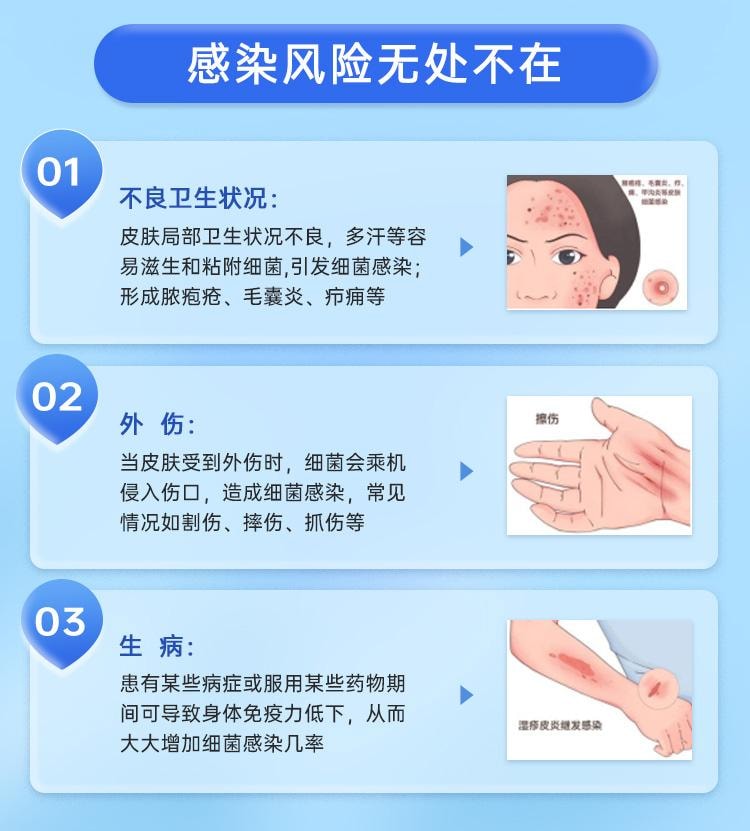 【中国直邮】孚诺  复方多粘菌素B软膏0激素 痘痘 毛囊炎 细菌感染  10g*1支/盒