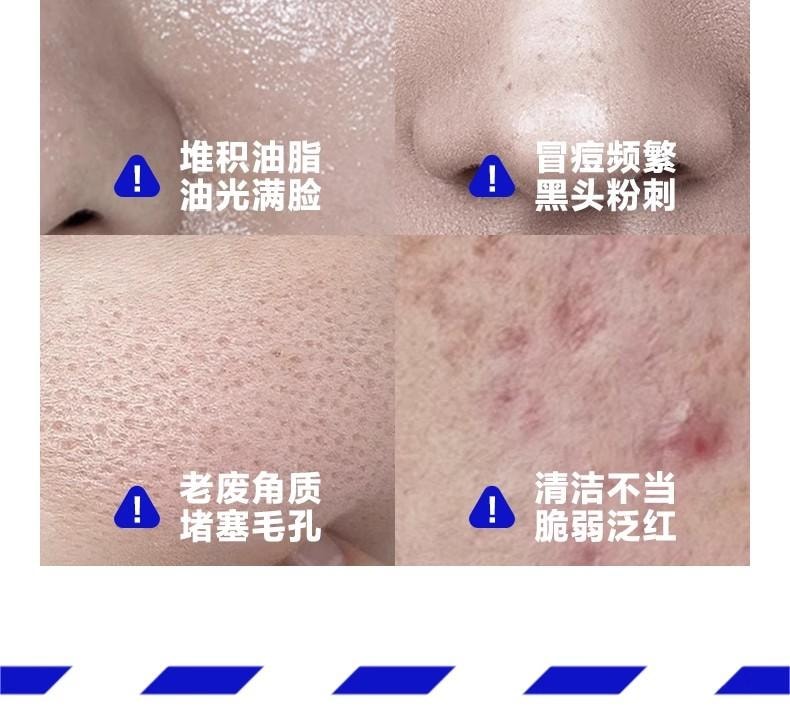 【中國直郵】 海洋至尊 三角鏡祛痘洗面乳 男士專用控油清潔黑頭氨基酸潔面乳 150g/瓶