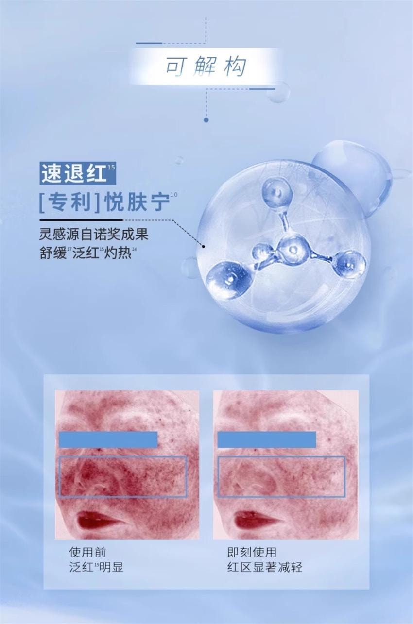 【中國直郵】 韓國 AHC 修紅瓶水乳套裝 敏感肌乾皮水潤護膚維穩保濕修護【115ml水+100ml乳液】