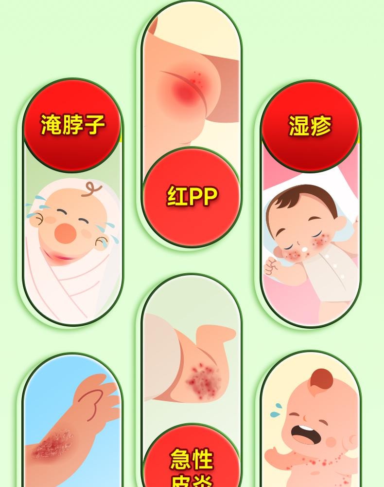 【中國直郵】 信龍 氧化鋅軟膏嬰兒紅屁屁濕疹痱子皮膚炎止癢專用藥膏 20g/盒