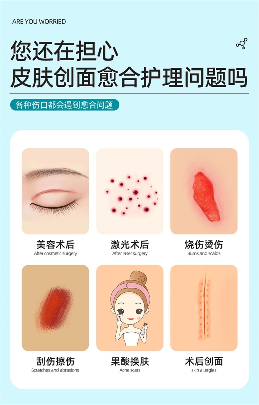 【中国直邮】 纽利安 医用三型人源化胶原蛋白皮肤修复护理膜重组人体表皮成长因子凝胶  20g/支