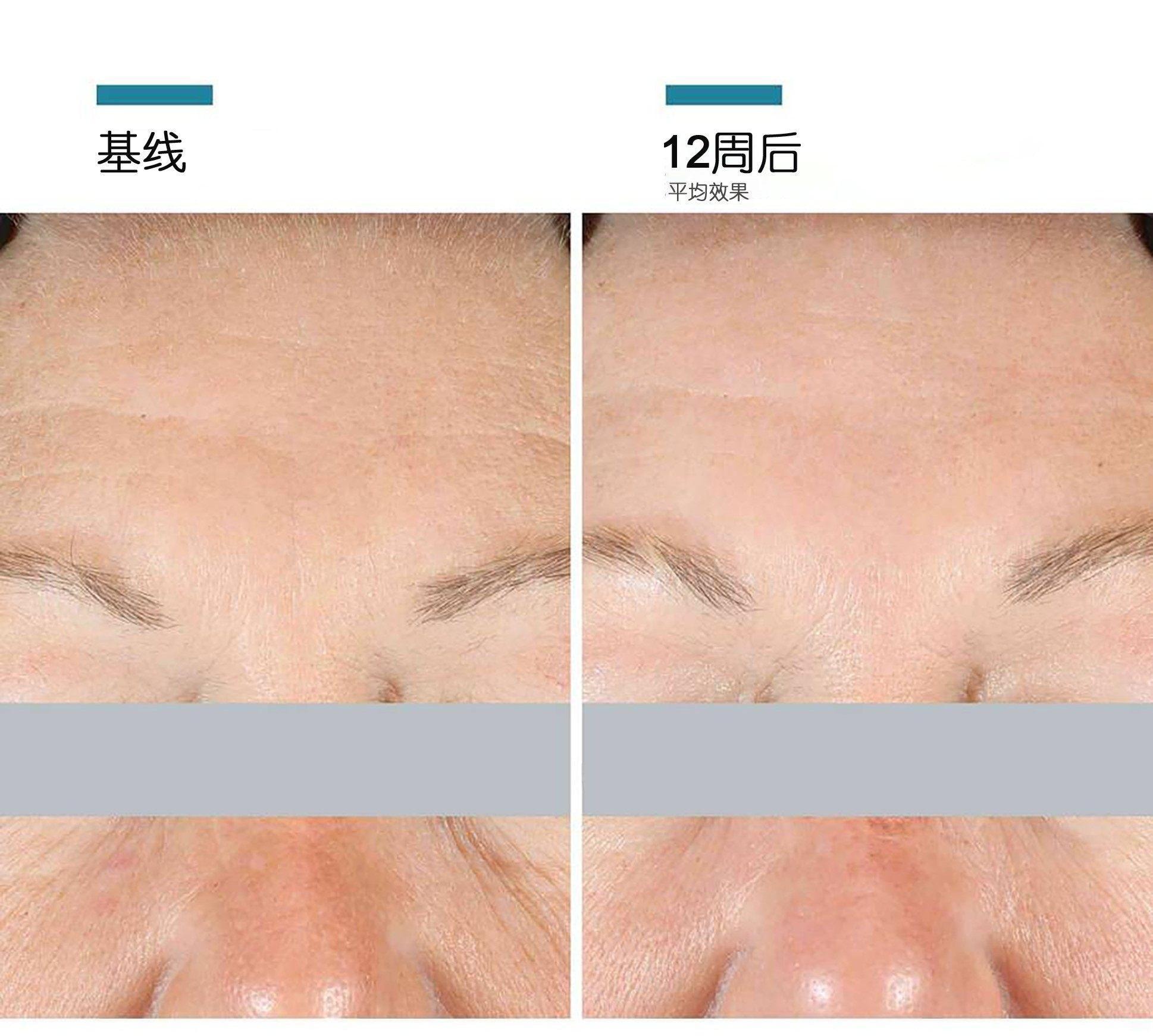 【香港直邮】 美国 SKINCEUTICALS修丽可 修丽可 AGE面霜15ml 杜克紧致塑颜精华霜  30%玻色因 抗糖化抗老