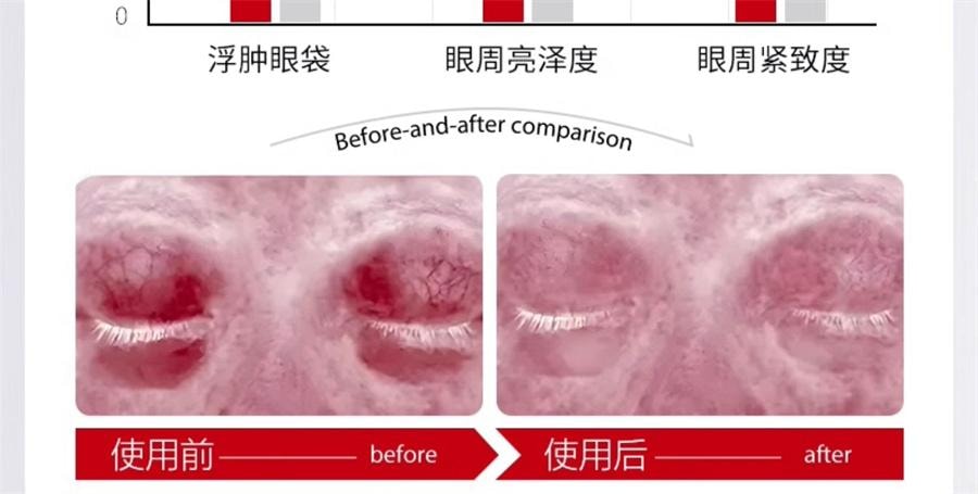 【中國直郵】 ORGINESE 眼膜貼淡化祛黑眼圈消皺細紋抗衰去除眼袋提拉緊緻神器女男士 60片/盒