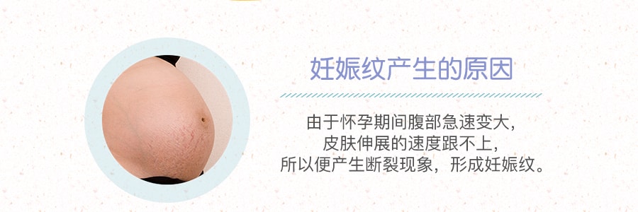 【无包装特价】日本MAMA&KIDS妈妈宝贝 预防妊娠纹护理乳液 孕妇身体乳 滋润保湿 预防淡化肚纹 470g