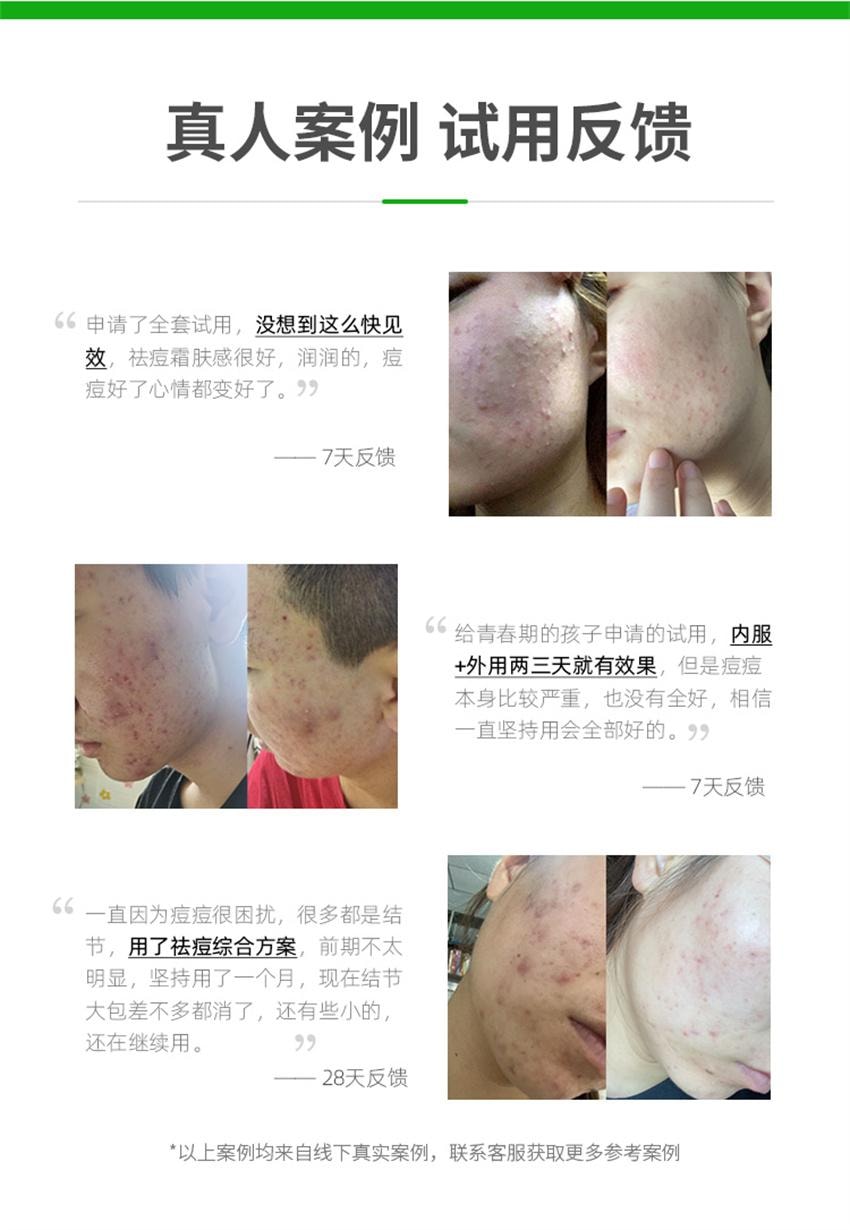 【中国直邮】 汉苑良方 颜清胶囊 祛痘内调口服养颜胶囊 男女调理痘痘粉刺闭口痤疮正品 120粒/盒