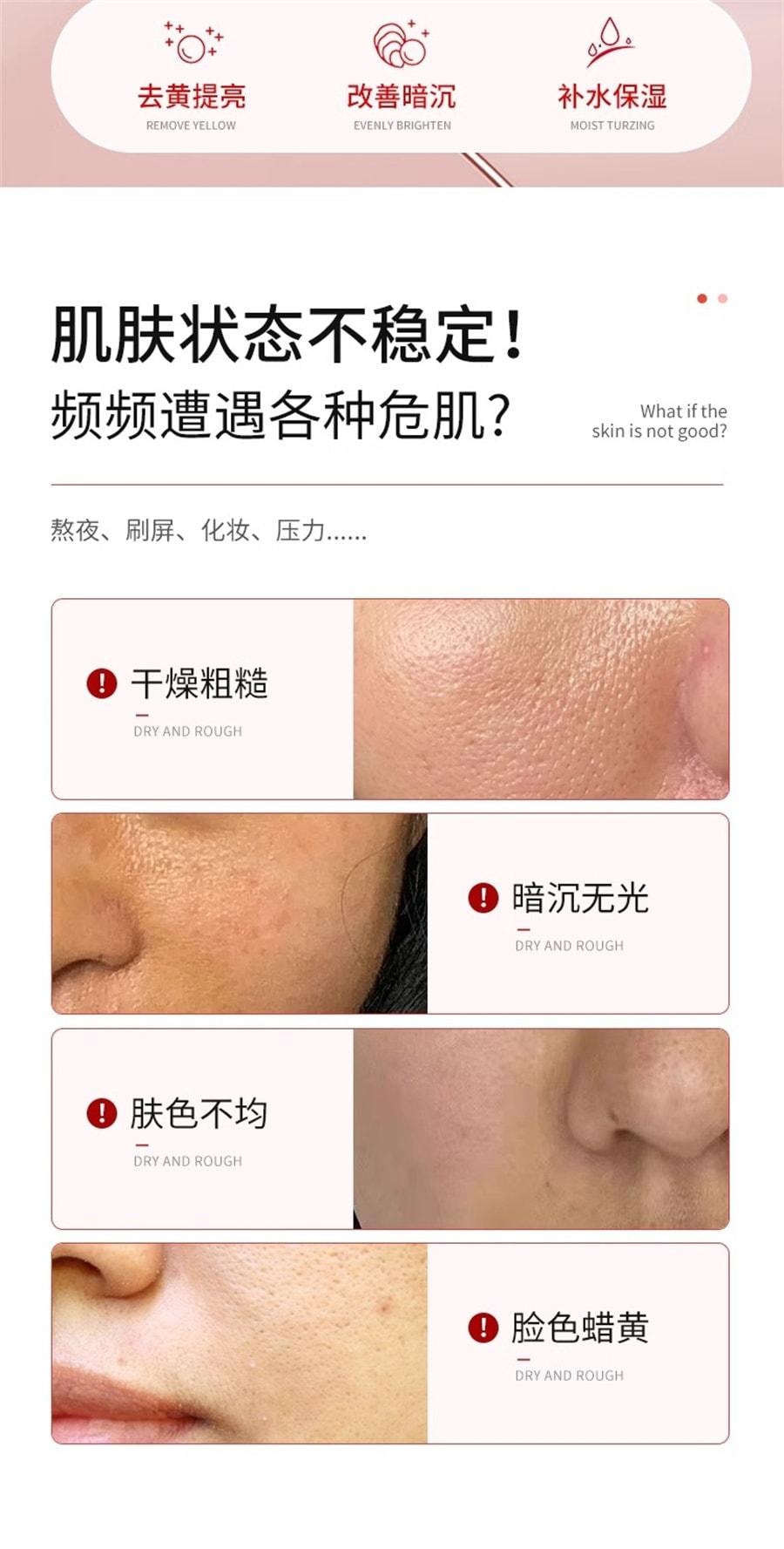 【中國直郵】 臻羞 複方熊果苷乳膏非醫用去黃乳霜改善暗沉菸鹼醯胺凝膠 30g