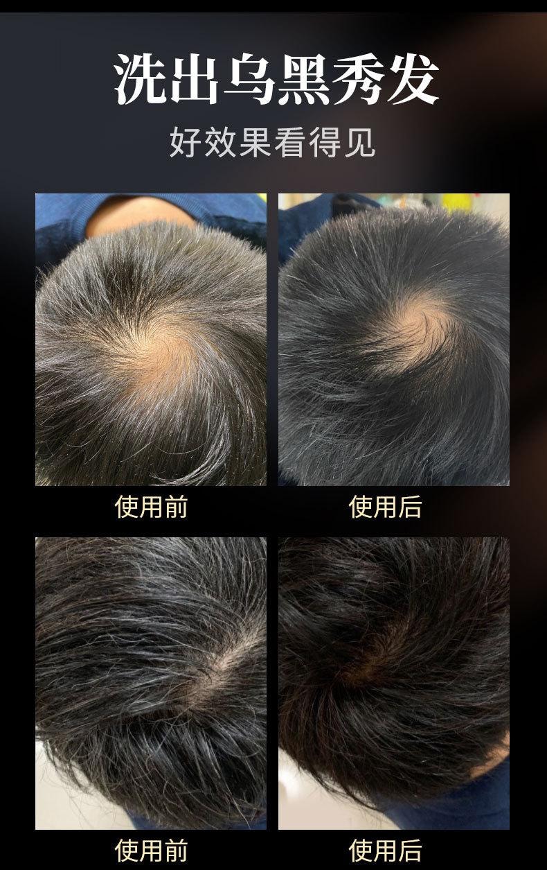  南京同仁堂 白髮轉黑自然黑髮滋養柔順髮皂 黑靈芝人參何首烏精華皂100g