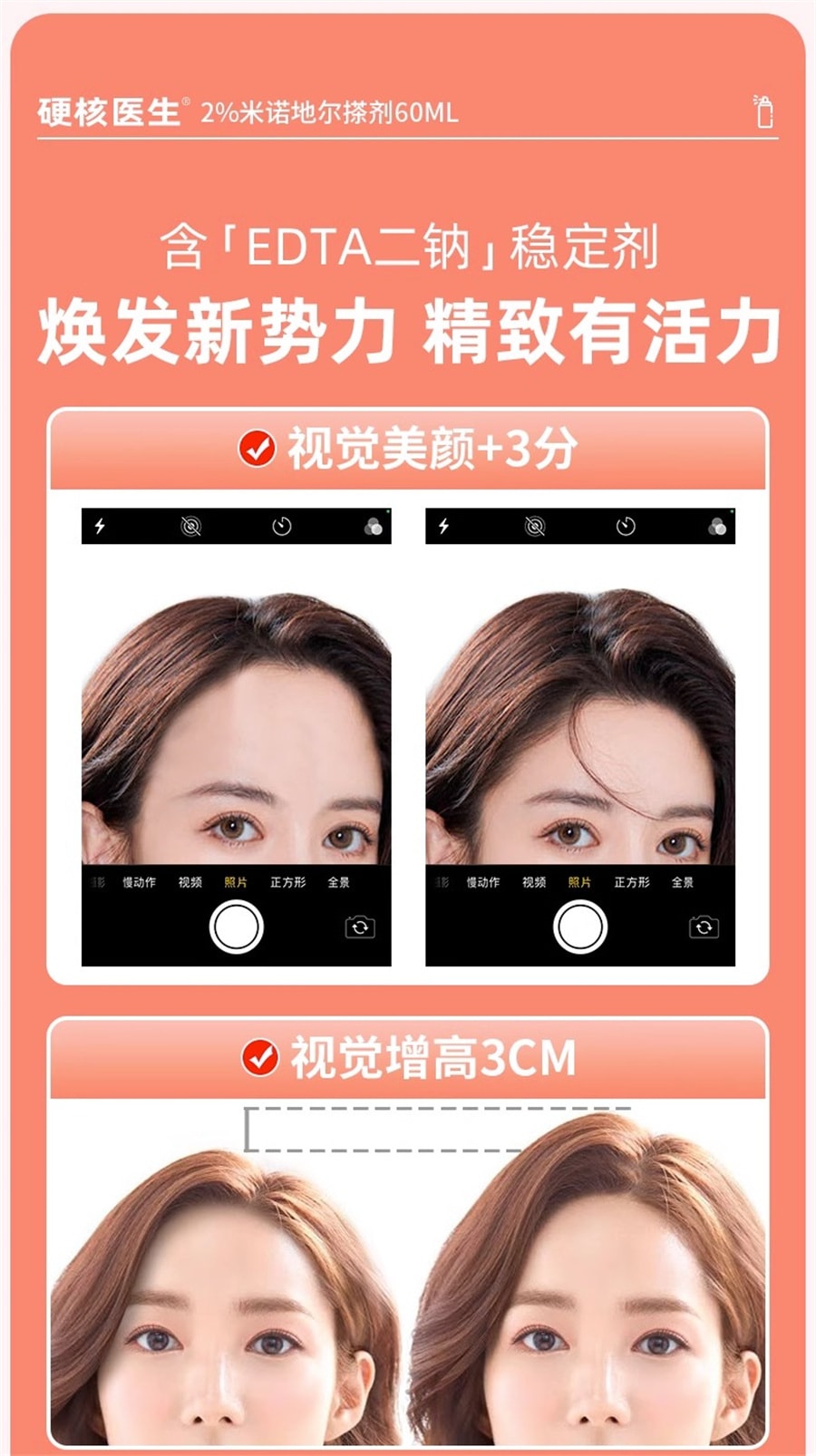 【中國直郵】硬核醫師 女性專用2%米諾地爾搽劑酊生髮液育發防掉髮擦劑町 60ml/盒