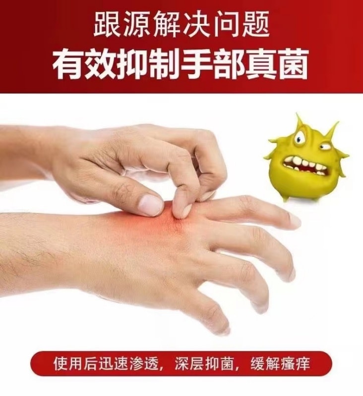 【中國直郵】 嚴和 汗疹草本乳膏 小水泡手癢皮膚搔癢蚊蟲叮咬抑菌止癢膏 15g/盒