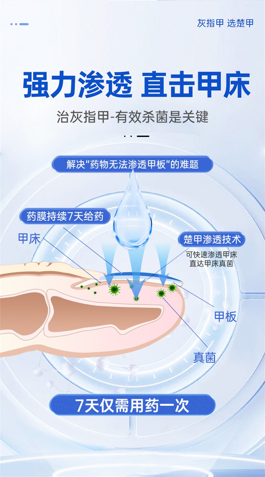 【中国直邮】楚甲 盐酸阿莫罗芬搽剂 灰指甲正品治疗脚气甲癣  1.5ml/盒