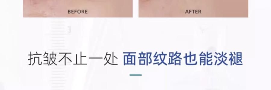 VOOLGA敷尔佳 小熨斗一刻抚纹晶透眼膜 5对入*2 抗皱紧致 淡纹眼下细纹鱼尾纹法令纹木偶纹 眼周救急 补水保湿 敏感肌适用 【超值装】