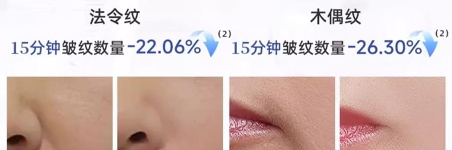 VOOLGA敷尔佳 小熨斗一刻抚纹晶透眼膜 5对入*2 抗皱紧致 淡纹眼下细纹鱼尾纹法令纹木偶纹 眼周救急 补水保湿 敏感肌适用 【超值装】