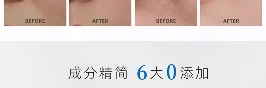 VOOLGA敷尔佳 小熨斗一刻抚纹晶透眼膜 5对入*2 抗皱紧致 淡纹眼下细纹鱼尾纹法令纹木偶纹 眼周救急 补水保湿 敏感肌适用 【超值装】