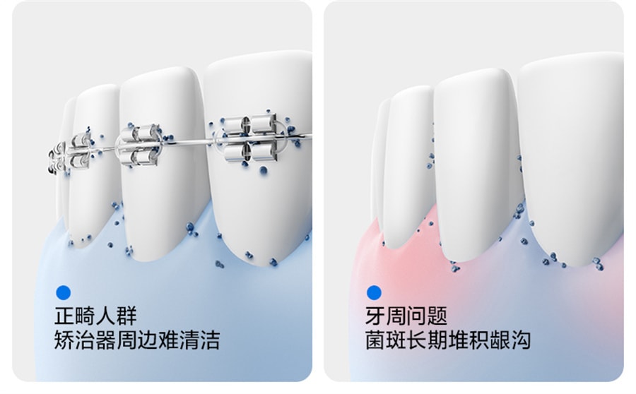 【中国直邮】笑容加USMILE  超声波冲牙器家用洗牙器水牙线便携式齿电动深度清洁  超声白CY0