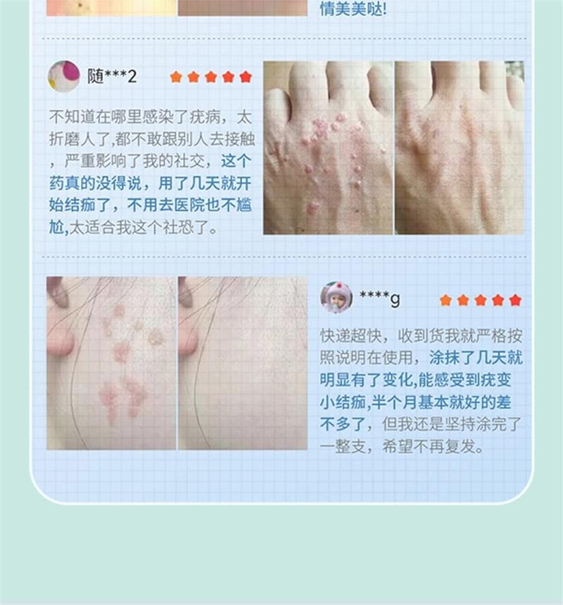  祥医堂 脖子肉粒丝状扁平疣去疣不留根 嘧腚抑菌克疣膏20g