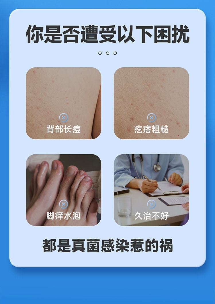 【中國直郵】仁和 聯苯芐唑溶液腳氣噴霧藥腳氣止癢脫皮殺菌 70ml/盒