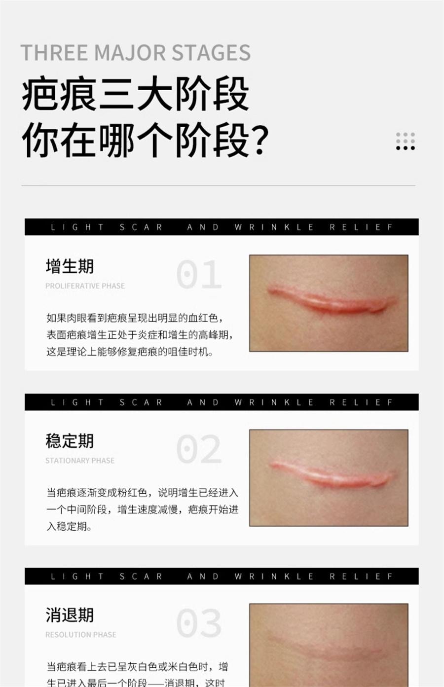 【中国直邮】 思恩 医用硅酮凝胶原蛋白护理疤痕修复膏烫伤手术增生剖腹疤痕   20g/支