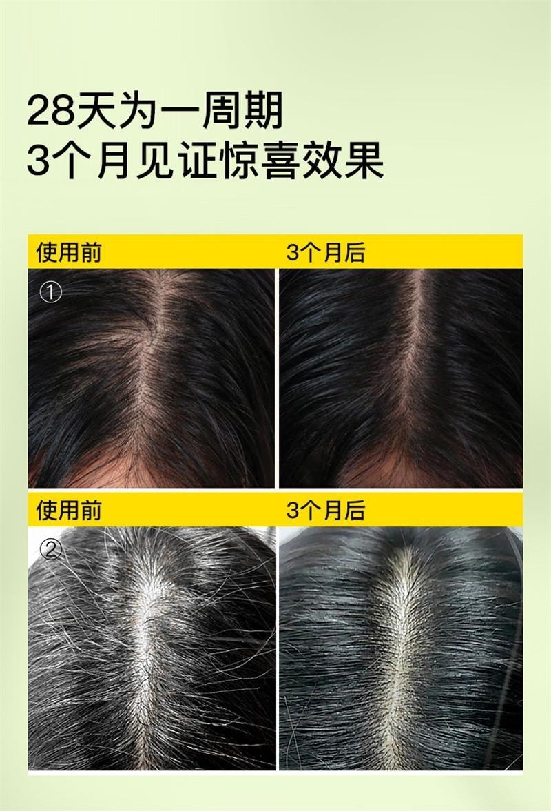 【中国直邮】 Mama Mujer 乌飞姿豌豆苗多肽头皮肌能精华液8ml*6支1盒