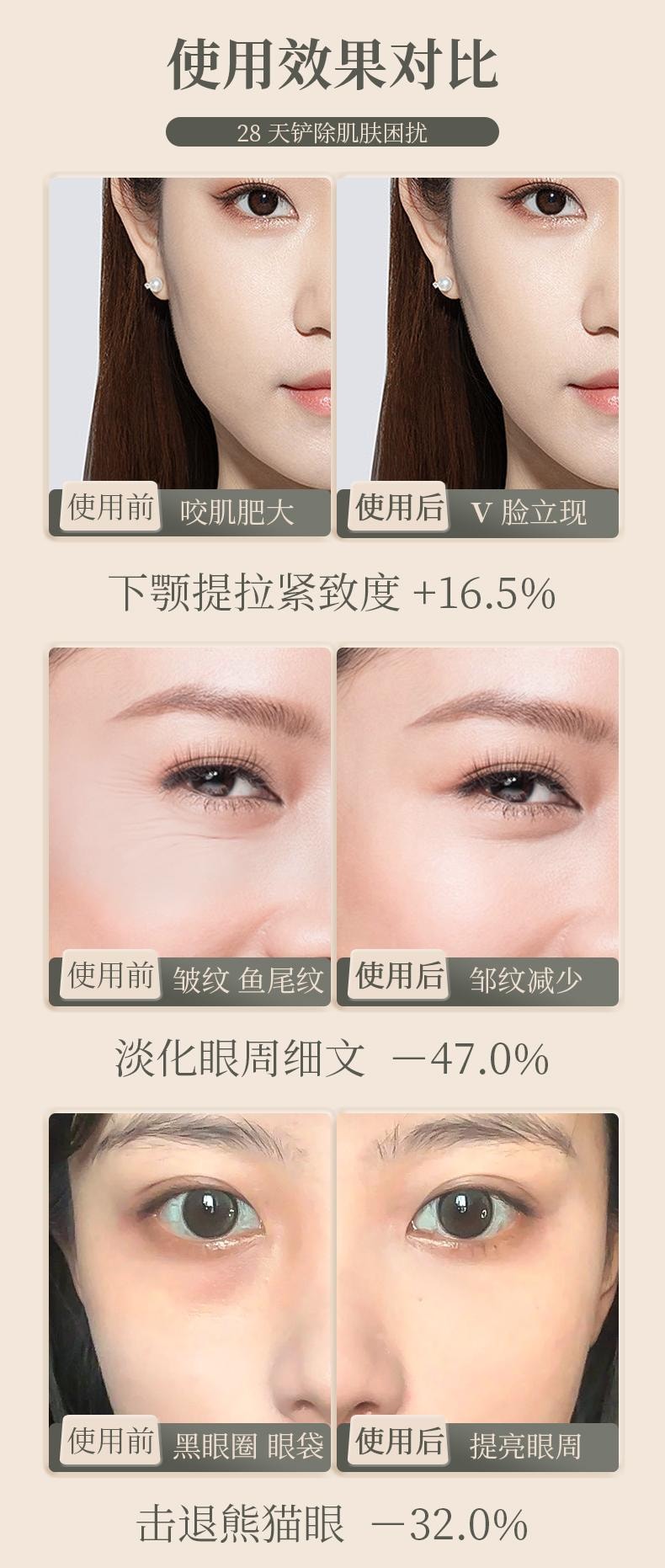 爱神严选 【博主明星推荐】人鱼面部刮痧板瘦脸仪1支 眼部滚轮按摩棒  消水肿 提拉紧致 清晰下颚线 改善黑眼圈   拨筋点穴棒工具