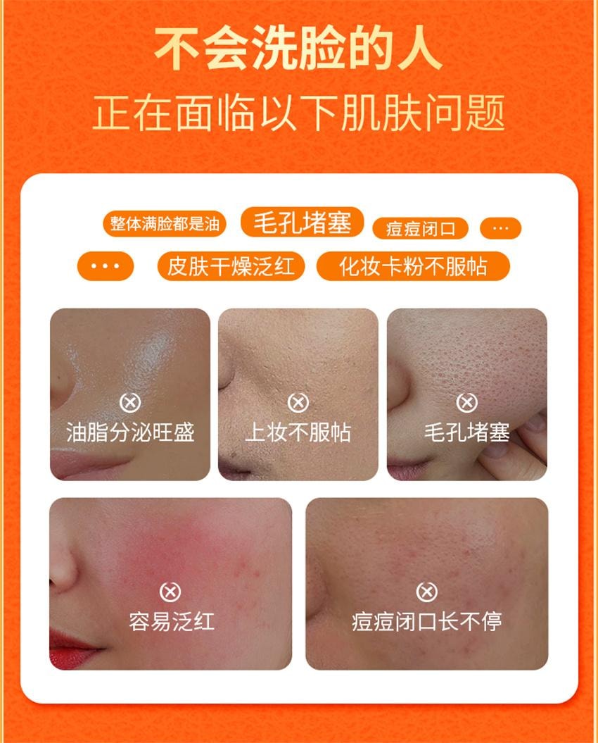 【中国直邮】 VC 五重维C洁面乳 洁净黑头 细腻毛孔 控油舒缓 保湿控油洗面奶 100g/支(1瓶多用)