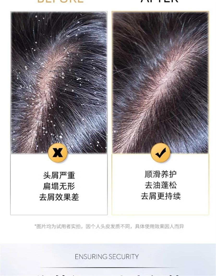 【中国直邮】 采乐 去屑洗发水 去屑去痒去油蓬松去油 氨基酸顺滑养护 去油蓬松 去屑更持续 200ml/瓶