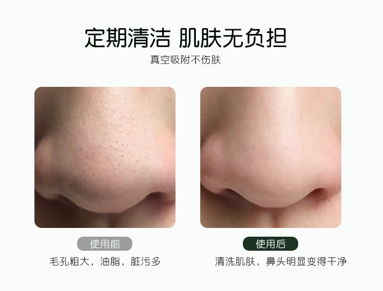 金稻电器 多功能美容仪 深层清洁 毛孔清洁 吸黑头仪 去粉刺小气泡 KD802P 绿色1台