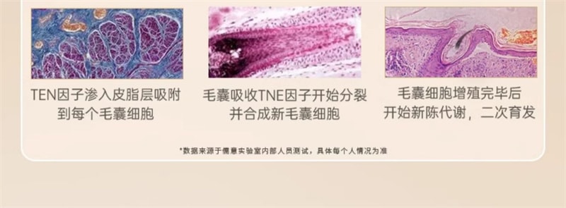 【中國直郵】 儒意 蔓濃烏發育髮液 頭髮際線營養劑發增密快速增長多男女生防脫神器 100ml/瓶(2瓶裝)