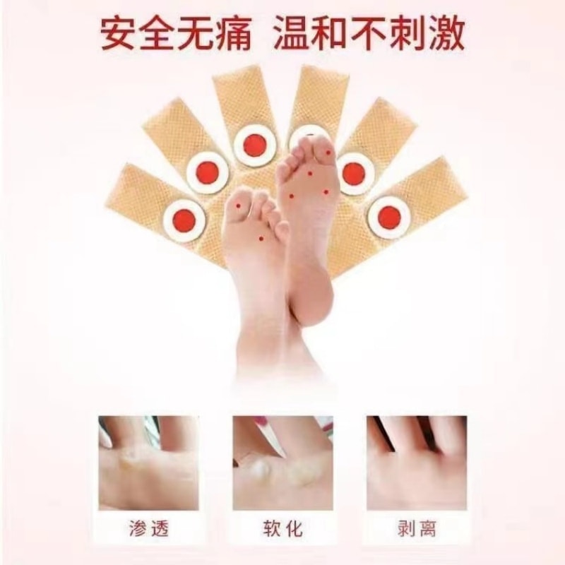Acupoint Pressure Corns Patches For Hand And Foot Elimination 6 Patches/box