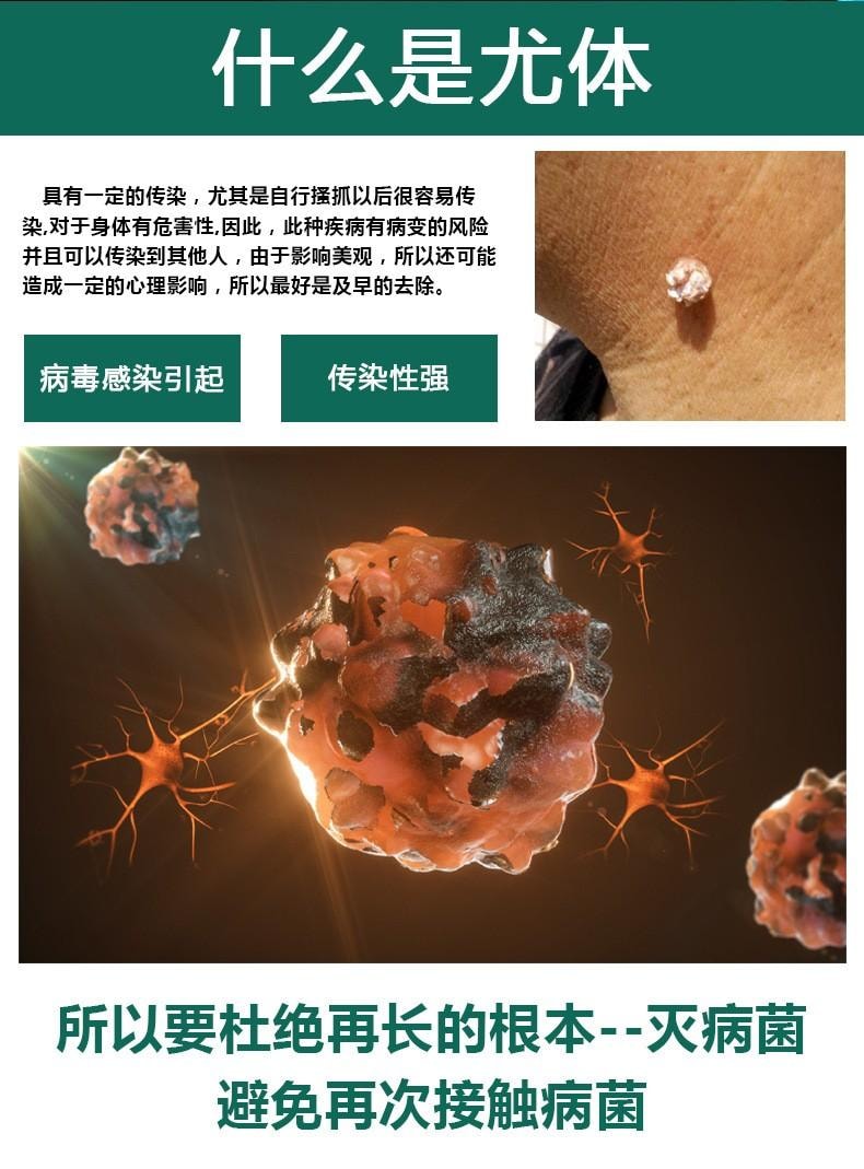  祥醫堂 絲狀扁平疣克尤刺瘊脖長小肉粒外用藥膏 5%咪喹莫特乳膏20g