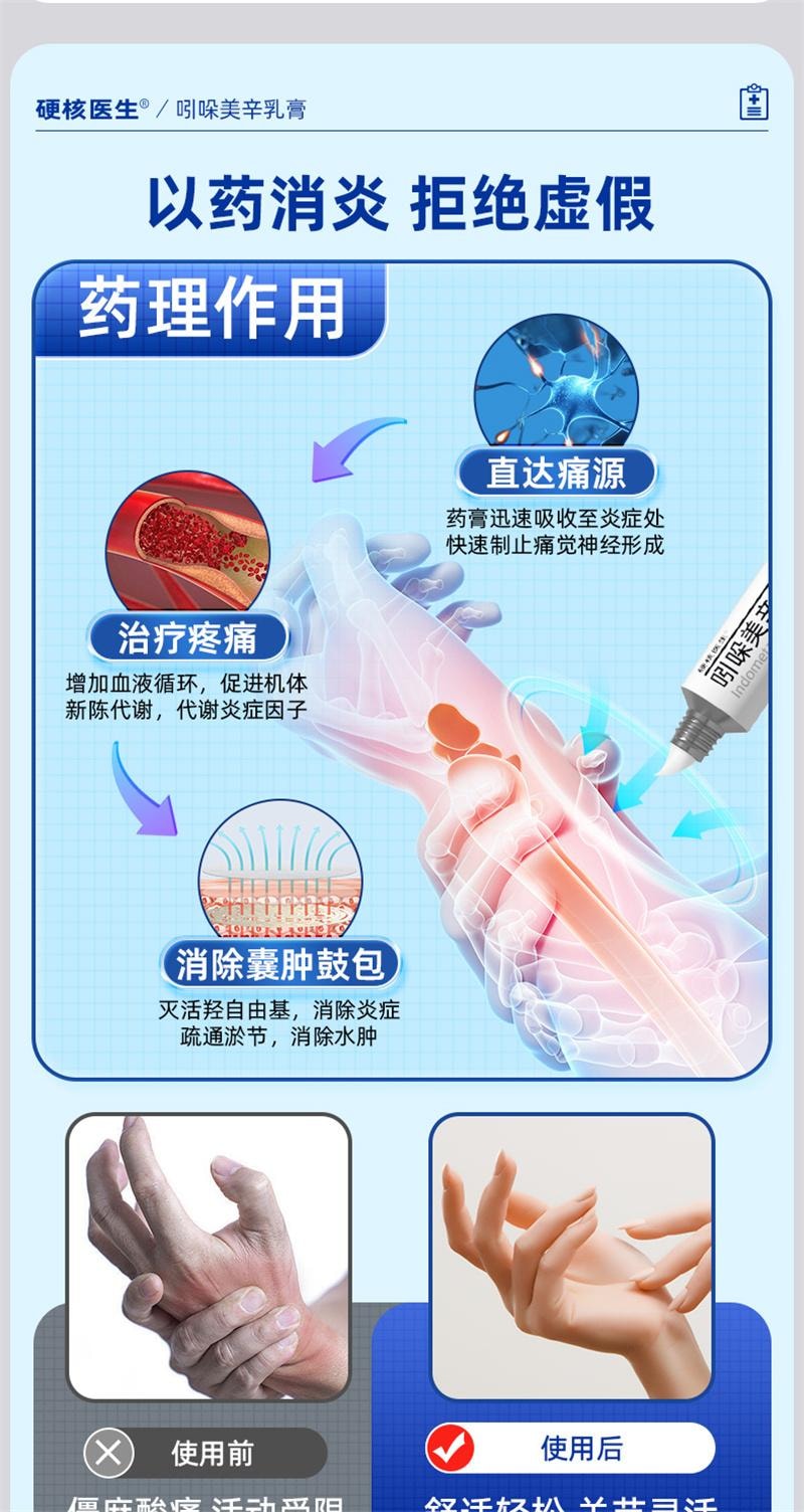 【中國直郵】 硬核醫師 吲哚美辛乳膏 腱鞘炎藥膏手指關節疼痛特效藥專治大拇指手腕專用貼膏藥健鞘囊腫 30g