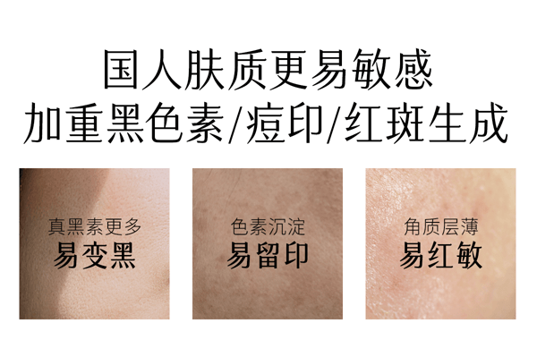  谷雨 【皇牌-囤货装2盒】新一代精华奶皮面膜 美白补水【淘宝No.1提亮面膜】【更适合亚裔肤质】【美白持证】去黄气暗沉 提亮肤色 淡斑 熬夜 修护淡印 (1.5ml+30ml)*5片/盒